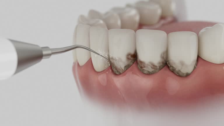 Trusted Teeth Cleaning And Checkup service in Huntland, TN - Dentist Open Now